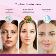 Kozicare Kojic Acid Soap & Glutathione Soap | Bathing | Bath for Men & Women | for Bath | Moisturize Skin | Fades Dark Spots | Gentle Exfoliation - 75Gm