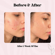 BodyLove Korean PDRN Stick Glow Balm | PDRN Essence Stick for Deep Hydration, Glow & Fine Lines | Po