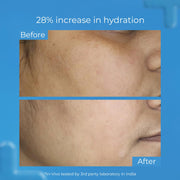 SKINQ Hydrate Face serum with Hyaluronic Acid Serum for Dry & Dehydrated Skin | +140% Instant Hydration, Boosts Plumpness | With Vitamin B5 & E | Lightweight, Non-Sticky | All Skin Types | Made by Dermat | 30ml