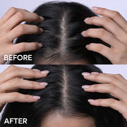 Naturali Anti-Dandruff Hair Mask With Sage & Salicylic Acid | Clarifies Scalp | Reduces Itchiness | 