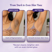 Sanfe Intimate Lightening Serum - 50g | For Dark Underarms, Inner Thighs, Knees And Bikini Area | With Kojic Acid, Vitamin C, Natural Lemon and Mulberry Extracts (Intimate Lightening Serum - 50 gms)