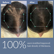 ThriveCo Hair Growth Serum 2.0 | Clinically Proven to Reduce Hair Fall & Boost Hair Growth | Powered by Redensyl, Procapil & Anagain | Backed by British Medical Research | Lightweight, Non-Sticky | For Men & Women – 30ml