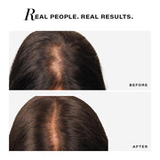 Novology Follicle Revive Scalp Serum for Hair Growth 50ml | Zinc & Niacinamide | For Hair Loss, Dry 