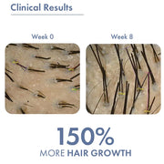 ThriveCo Hair Growth Serum 2.0 | Clinically Proven to Reduce Hair Fall & Boost Hair Growth | Powered by Redensyl, Procapil & Anagain | Backed by British Medical Research | Lightweight, Non-Sticky | For Men & Women – 30ml