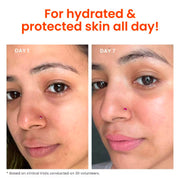 Foxtale Dewy Finish SPF 50 PA++++ Sunscreen For Dry Skin, Deeply Hydrates, In-Vivo Tested - 50ml