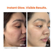 Foxtale Vitamin C Super Glow Moisturizer with Niacinamide & Peptides, Visibly Reduces Pigmentation, Enhances Skins Brightness Instantly, For All Skin Types, Women & Men - 50ml, Cream