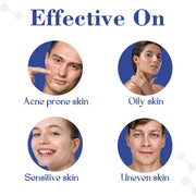 Healing Pharma - AcneTop S Face Wash with Salicylic Acid and Glycolic Acid for Oily, Dry & Acne Prone Skin | Helps to Reduce Pimples, Pigmentation & Dark Spots | Acne Face Wash For Women and Men | Dermatologically Tested - 60ml