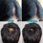 Pilgrim Advanced Hair Growth Serum Roll On with Redensyl & AnaGain - 25ml