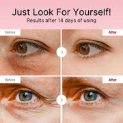 BodyLove Korean Retinol Under Eye Balm Stick | 7-in-1 Eye Care with Retinol, Peptides, Marine Collag