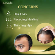 Auravedic Advance Hair Growth Serum For Scalp with 3% Redensyl, 2% Anagain, 3% Procapil, Caffeine, Biotin, Bhringaraj, Rosemary Oil For Hair Serum For Hair Fall Control 30ML