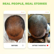 Avimee Herbal Keshpallav Hair Oil for Hair Growth | For Both Men & Women | Helps to reduce Hair Fall | With Rosemary, Castor, Amla, Coconut and Bhringraj Oil | Mineral Oil Free | 100 ml