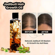 Ayurvedic Jadibuti Hair Growth Oil | Herbal Hair Oil for Hair Regrowth, Hair Fall Control, Dandruff & Scalp Care | Natural Ayurvedic Formula 200ml