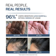 Bare Anatomy Anti Hair Fall Shampoo | 5x Hair Fall Control & Growth |Contains Biotin Adenosine, & Peptides|Paraben & SLS Free | For All Hair Types | For Women & Men | 250ml