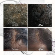 Bontress PRO+ Scalp Serum | Powered by Pro Active Peptides – 5% Capixyl, 3% Redensyl, 3% Anagain, 3% Procapil | Dermat recommended Hair Growth Serum | 94% Users Reported Hair Growth in 28 Days