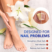 Fungal Nail Patch Fungus Toenail Fingernail Care Antifungal Patches Overnight Support Solution Treatment Appearance Repair Health At Home Aid Remedy Maintenance Fungal Nail Patch 21pcs