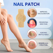 Fungal Nail Patch Fungus Toenail Fingernail Care Antifungal Patches Overnight Support Solution Treatment Appearance Repair Health At Home Aid Remedy Maintenance Fungal Nail Patch 21pcs