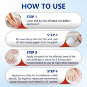 Fungal Nail Patch Fungus Toenail Fingernail Care Antifungal Patches Overnight Support Solution Treatment Appearance Repair Health At Home Aid Remedy Maintenance Fungal Nail Patch 21pcs