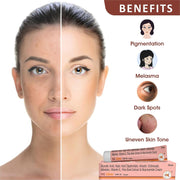 HealNCure NG Glow Cream - Enriched With Kojic Acid &Glycolic Acid