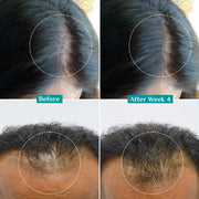 Pilgrim Advanced Hair Growth Serum with 3% Redensyl & 4% AnaGain -30ml