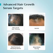 Pilgrim Advanced Hair Growth Serum with 3% Redensyl & 4% AnaGain -30ml