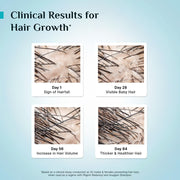 Pilgrim Advanced Hair Growth Serum with 3% Redensyl & 4% AnaGain -30ml