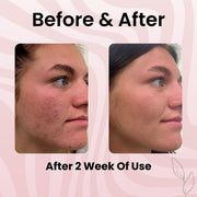 BodyLove Korean Collagen Night Wrapping Peel Off Mask 100ml | Overnight Glass Skin Mask with Hydroly