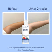 WishCare 10% AHA + 1% BHA Body Lotion for Men & Women - Body lotion for dry skin - Detans, Smooths Rough & Bumpy Skin 200ml