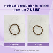 Bare Anatomy Nature x Science Rosemary Hibiscus Hair Growth Oil for Women & Men | Promotes New Hair Growth & Strengthens Hair | Nourishes Scalp & Controls Hair Fall | Suitable for All Hair Types-100ml