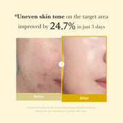 BodyLove Kojic Acid Turmeric Overnight Wrapping Peel Off Mask | Fades Dark Spots, Tan & Pigmentation