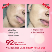 Outshine Korean Face Serum – Fades Dark Spots & Brightens Skin with Glutathione, Niacinamide & Vitamin C