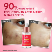 Outshine Korean Face Serum – Fades Dark Spots & Brightens Skin with Glutathione, Niacinamide & Vitamin C