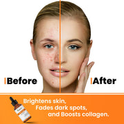 vitamin c & ferulic acid serum