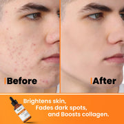vitamin c & ferulic acid serum